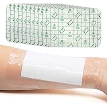 Adhesive Wound Dressings, 10x25cm Waterproof Wound Bandage For Swimming Shower, Wound Dressings Pads For Cuts, Grazes 10Pcs - View #2