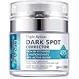Dark Spot Remover for Face & Body, Dark Spot Corrector for Women and Men with Arbutin and Niacinamide, Reduces Hyperpigmentation, Age Spots, Sun Spot, Improve Skin Tone, for All Skin Types