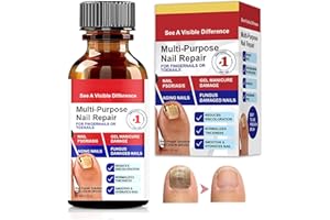 GELPRETTY 30ml Nail Care Flüssig,Fördert gesundes Nagelwachstum,Stärkung brüchiger Nägel,Für Reparatur und Schutz der Nägel,Geeignet Nagellack für Füsse und Hände