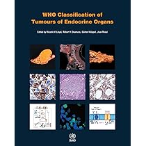 語学+参考書 Pathology And Genetics of Tumors of Endocrine Organs (World Health Organization Classification of Tumours) World Health Organization Classification of Tumours of