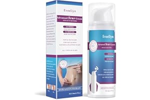 Eveellyn Narbensalbe, Narbengel, fortschrittliche Narbencreme für chirurgische Narben, Dehnungsstreifen, Keloidnarben, Kaiserschnitt, Verbrennungen, Akne, behandelt alte und neue Narben, 1.7 oz (50g)