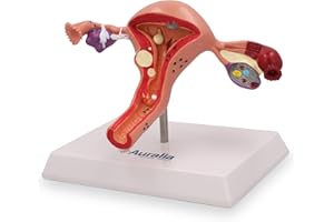 AURALIA MEDICAL GROUP Female Reproductive System Uterus Anatomy Model Medical Ovary Pathological Anatomical for Education