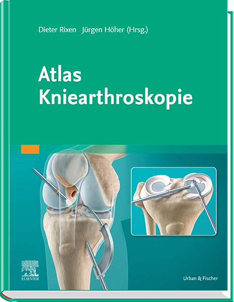 Atlas Kniearthroskopie Ebook Rixen Dieter Hoher Jurgen Amazon De Kindle Shop