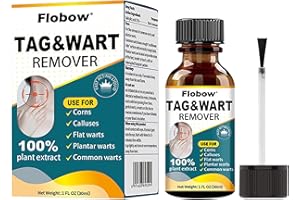 SHILEOO Eliminador de verrugas y marcas en la piel 30 ml