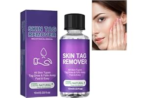 GNAUMORE Natural Skin Tag Removal,Natural Ingredients Skin Tag Removal,Wart & Mole Remover,Safe & Effective,Easy to Use at Home,Suitable for Face and Body