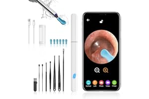 ‎MORELAX Ohrenschmalz-Entferner, Morelax 1080P WiFi-Ohrenreiniger, IP67 wasserdichtes Otoskop mit 360°-Kamera, Ohrendoskop mit 6 LEDs für iPhone, Android, iPad, Erwachsene, Kinder und Haustiere (Weiß)