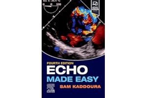Echo Made Easy