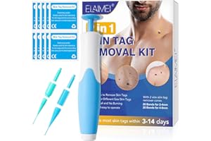 ZBQIEX 2 in 1 Skin Tag Remover Kit for Face Neck & Body, Upgraded Auto Fast and Easy Stem Warts Removal Pen for Micro to Large (2mm-8mm), with 40 Removal Bands 10 Cleansing Wipes, Safe and Painless