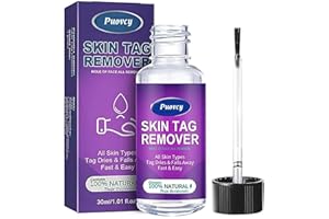 PUOVCY Skin tag Removal kit: Natural Removal Without Leaving Traces, Non-irritating, Hand and Body wart Remover, Suitable for All Kinds of People 30ml