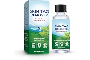 RUNADI Verruche Rimozione, Verruche Rimozione Fibromi Piedi, Skin Tag Wart Remover Liquido per Mani Viso 30ML