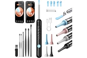 ‎QIMIC Qimic Ohrenschmalz Entferner Otoskop, WiFi Ohrreiniger, IP67 Wasserdicht und 360°-Weitwinkel Otoskop Kamera mit 6 LEDs für Erwachsene, Kinder und Haustier, Schwarz