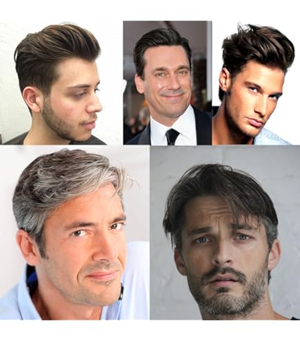 Sistemi Per Capelli A Pelle Sottile 101: Tutto Quello Che Devi Sapere - Foto 7