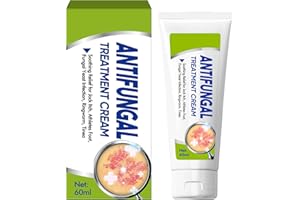 VOKY Crema per Micosi – Azione Intensa contro Fastidi Cutanei Idrata e Ripara la Pelle Secca e Irritata, 60 ml