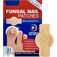Pilz-Nagel-Patches (300 Stück) – Zur Behandlung, Reparatur & Korrektur Von Zehennägeln, Für Gesunde, Schöne Nägel
