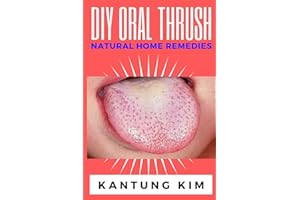 DIY Oral Thrush Natural Home Remedies: The Effective Step By Step Guide To Permanently End Oral Thrush