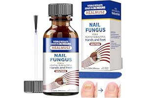 YOLONCE 30ml Ongles Réparateurs,Soin professionnel pied/main,Réparateurs ongles,Favorisant la Repousse D'ongles Sains,Restaure l'aspect naturel de l'ongle