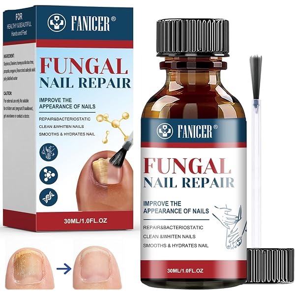 4 Stück Nagelreparatur-Stifte – Für Gebrochene, Verfärbte Fingernägel Und Fußnägel, Pflegende Formel