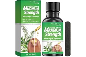 FLASSHFREZ Effective Nail Fungus Treatment for Toenails & Fingernails – Eliminates Infection, Repairs Damaged & Broken Nails, Promotes Renewal & Strengthens Nail Health – 30ml Bottle