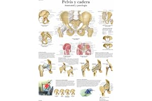 3B Scientific VR3172UU Impreso En Papel, Pelvis y Cadera, Anatomía y Patología