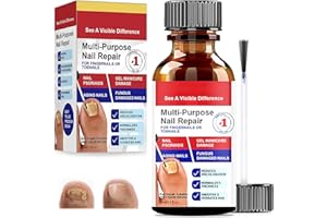 CHARMCHIC 30ml Reparadores De Uñas Solución, Tratamiento De Uñas Los Pies, Pueden Calmar Y Nutrir Las Fortalece La Uña, Cuidado Diaria Y Mejora Aspecto, Para Decoloradas Los Pies