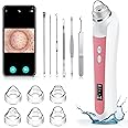 Ottleba Blackhead Remover Vacuum, USB Interface Type Pore Vacuum, Black Head Extractions Tool with Camerafor, Men and Women Pore Cleaner, 3 Adjustment Modes & 6 Suction Heads(Light Pink)