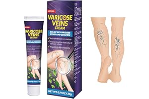 KOAHDE Varicose Vein Removal Cream,Vein Relief Cream,Spider Leg Repair Cream,Improves The Appearance of Leg,20g