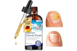 NAILPRETTY 30ml Nagelpflege Behandlung, Nagelpflege Pflegend, Schutz & Stärkung Brüchiger Nägel, Repariert Beschädigte Und Verfärbte Nägel