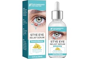 NNPCBT Stye Eye Treatment, Blepharitis Treatment, Natural Stye Treatment Drops for Styes Chalazion and Blepharitis
