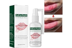 UJOOGBU Mouth Ulcer Treatment Spray,Mouth Ulcer Treatment for Adults,Canker Sore Treatment,Oral Care Spray,Herbal Mouth Spray,Canker Sores Relief Spray for Mouth Ulcer,Bad Breath Treatment,Mouth Freshener