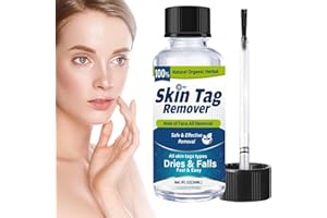 WERPOWER Skin-Tag-Removal-Kit-Skin-Tag-Remover, Effect Wart& Mole-Remover Liquid, Fast-Acting, Blue, 30ML