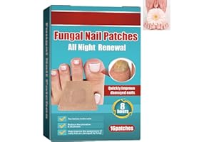 KOAHDE Adesivi per la Correzione delle Unghie dei Piedi,Cerotto per La Correzione Unghia Piede,Unghie Incarnite Piedi Adesivi,Cerotti per Correzione delle Unghie dei Piedi,Correttore Unghie Incarnite