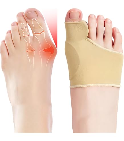 Bauerfeind Valguloc Bunion Splint - Stecca Per Alluce Valgo, Modello Sinistro, Taglia 2, Ortesi Notte E Giorno, Comfort E Supporto