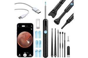 ‎VITCOCO Earwax Remover Otoscope, VITCOCO 1080P WiFi Ear Cleaner, IP67 Waterproof Ear Cleaner for iPhone, iPad and Android Smartphones (Black)