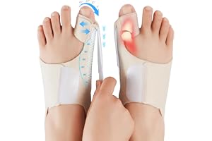 Hallux Valgus Korrigering – Justerbar Bunion Splint med Gelkudde för Smärtlindring – För Kvinnor och Män, En Storlek, 1 Par