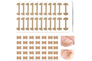 vaolmlop 101 Pcs Ongle Incarné Kit,Kit De Correction D'ongles Incarnés,Correction Des Ongles Des Orteils Incarnés,Orteil Kit De Traitement De Correction Des Ongles Incarnés