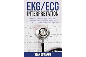 EKG/ECG Interpretation: Practice Methodology for a Rapid Interpretation, Diagnosis About the 12 LEAD ECG/EKG and all Tracing Cases