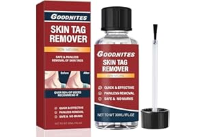Goodnites Fast-Acting Skin Tag Removal Kit, Natural and Gentle Formula, Zero Pain Skin Tag Remover, Suitable for Neck, Underarms, Groin, Trusted by The Whole Family, 30ML