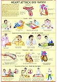 Heart Attack Chart