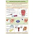 HP31S | TeachingNest | Contraception (Birth Control) Chart 70x100 cm | English | Human Physiology Chart | Synthetic | Wall Sticking [Wall Chart] teachingnest and Human Physiology Charts