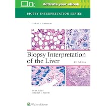 Buy MacSween's Pathology of the Liver Book Online at Low Prices in