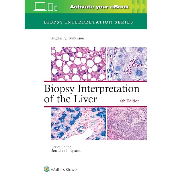 Buy MacSween's Pathology of the Liver Book Online at Low Prices in