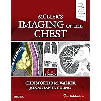 Buy Mullers Imaging Of The Chest With Access Code 2Ed (Hb 2019