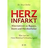 Herzinfarkt - Alternativen zu Bypass, Stent und Herzkatheter: Was tun bei Herz-Kreislauf-Erkrankungen? Warum heute oft zu sch