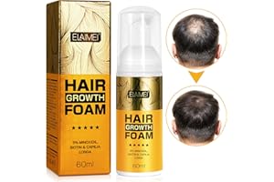 IDUCEN Haarwachstumsschaum, natürlicher Haarwachstumsspray, Feuchtigkeitsschaum gegen Haarausfall zur Reparatur von Haarwurzeln Kopfhautpflegeprodukt, milde, Nicht reizende Formel für Damen und Herren