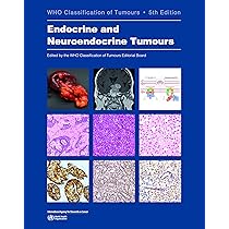 Buy Head and Neck Tumours: Who Classification of Tumours (World