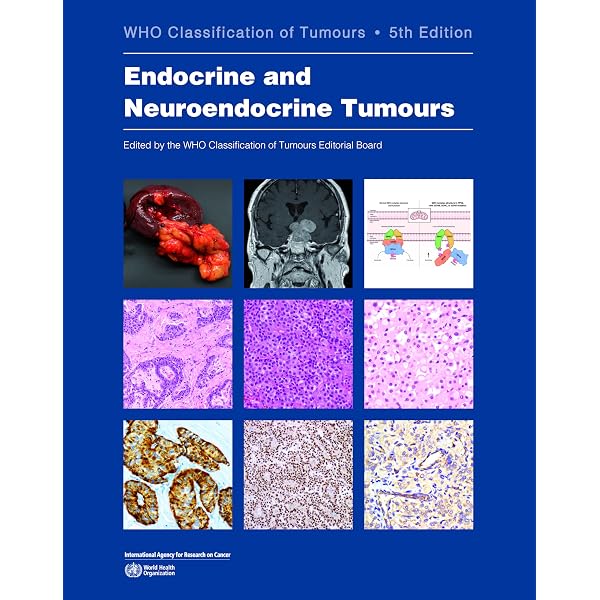 WHO Classification of Head and Neck Tumours 5th Edition: Who