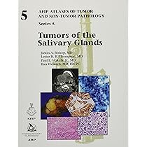 Buy Tumors of the Salivary Glands: 5 (AFIP Atlas of Tumor and Non