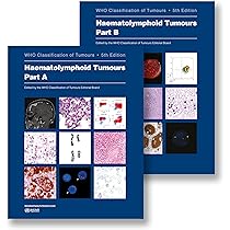 Buy WHO classification of tumours of soft tissue and bone tumours