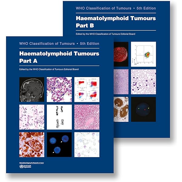 Buy WHO classification of tumours of soft tissue and bone tumours