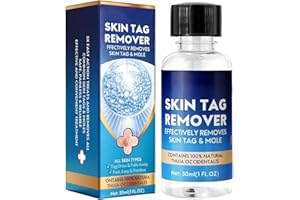 FELLFLYING Azote Liquide Anti-verrues, Acrochordons Traitement Efficace, Sérums D'élimination Des Acrochordons, Traitement Des Verrues Plantaires Et Génitales, Pour Tous Les Types De Peau